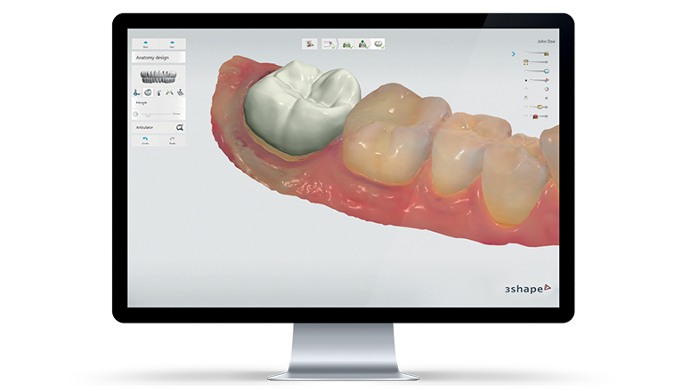 Computer displaying software for CAD/CAM dentistry