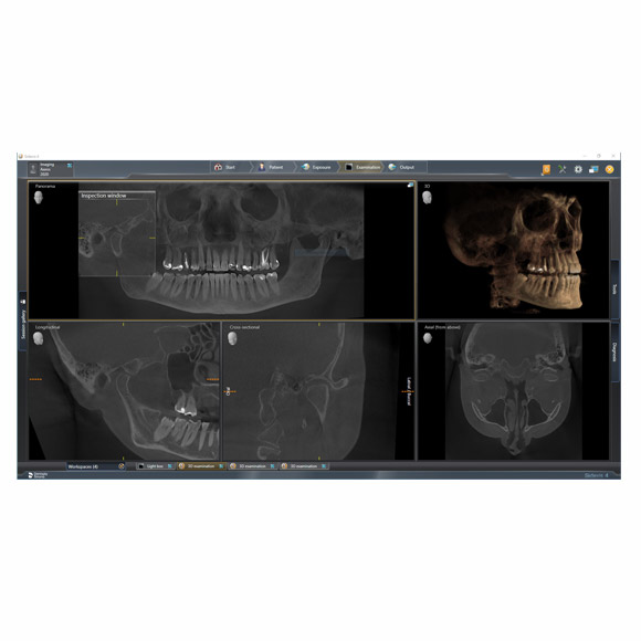 digital image from Dentsply Sirona Axeos 3D/2D Conebeam Imaging System