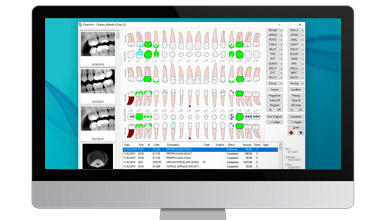 Eaglesoft dental software shown on a monitor