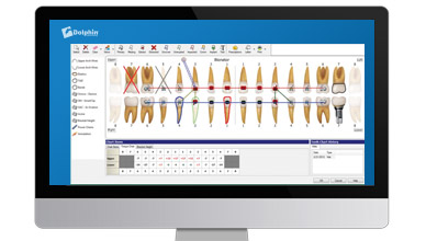 Dolphin dental software shown on a monitor