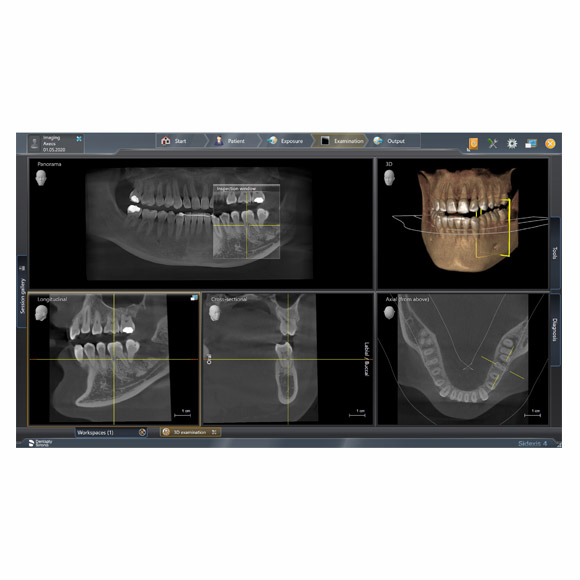 digital image from Dentsply Sirona Axeos 3D/2D Conebeam Imaging System