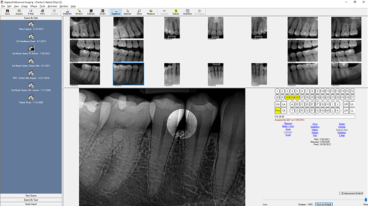 Screenshot of Eaglesoft dental practice management software showing the image acquisition and storage feature