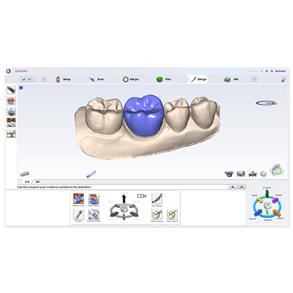 Planmeca PlanCAD Design Center Software