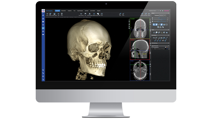 Image of a skull from the Planmeca Romexis Implant Module