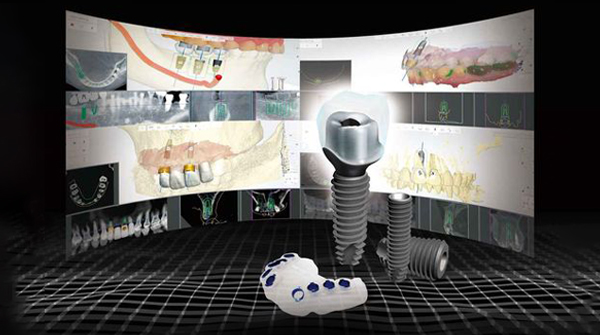 DIOnavi surgical implant guide