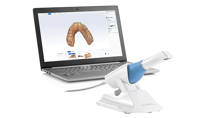 Planmeca Emerald S Intraoral Scanner | Patterson Dental