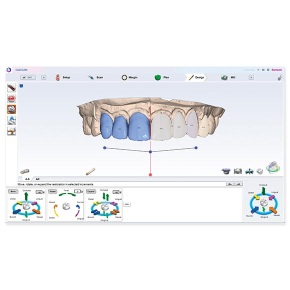 Planmeca PlanCAD Design Center Software