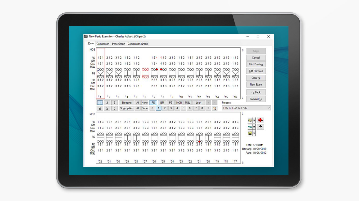 eaglesoft-software-patterson-dental