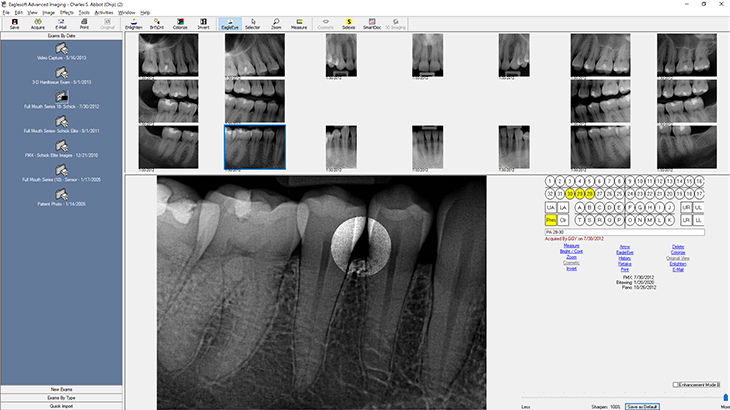 Eaglesoft Dental Practice Management Software | Patterson Dental